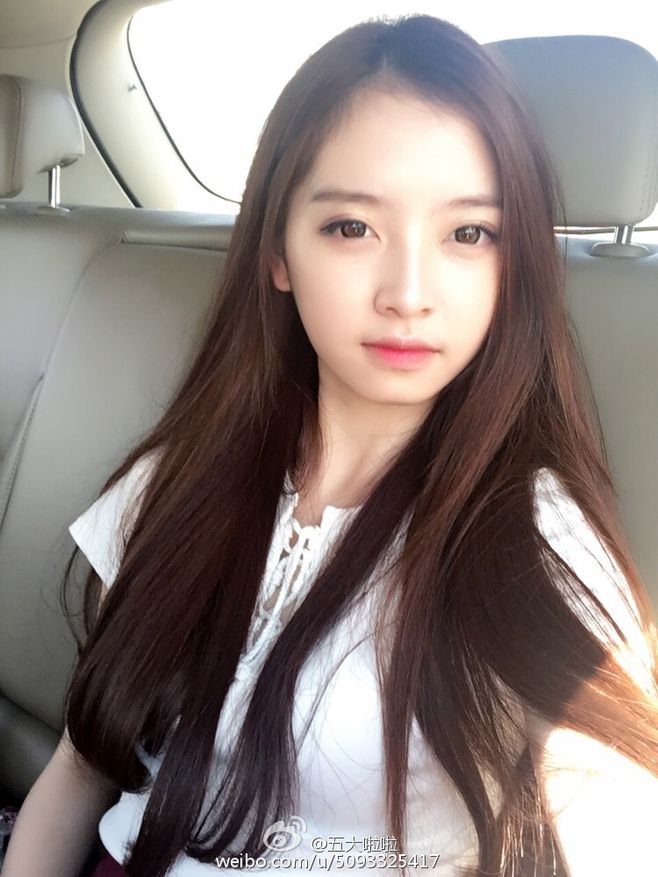 骨折后的四种症状特点-xc sports(图2) xc sports